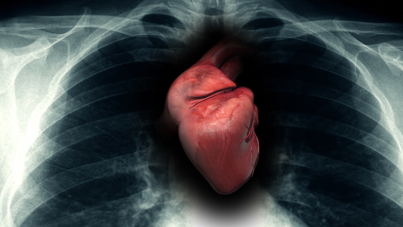 illustration of heart using x-ray imagery