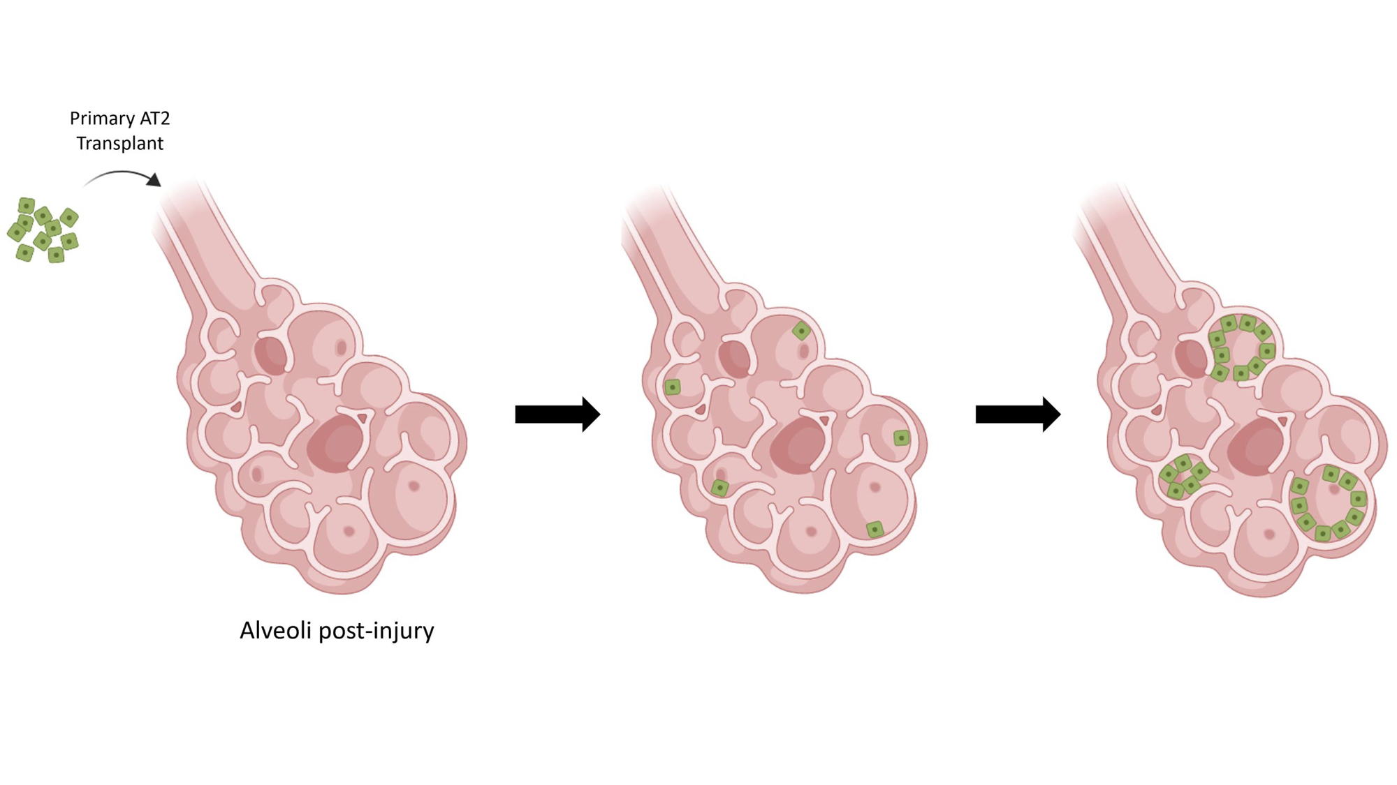 A cartoon depicts the lung's alveoli in three stages. The first shows a primary AT2 cell transplant in an alveoli post-injury, the second image shows green transplanted AT2 cells in the alveoli, and the third image shows the green cells reproducing inside the alveoli