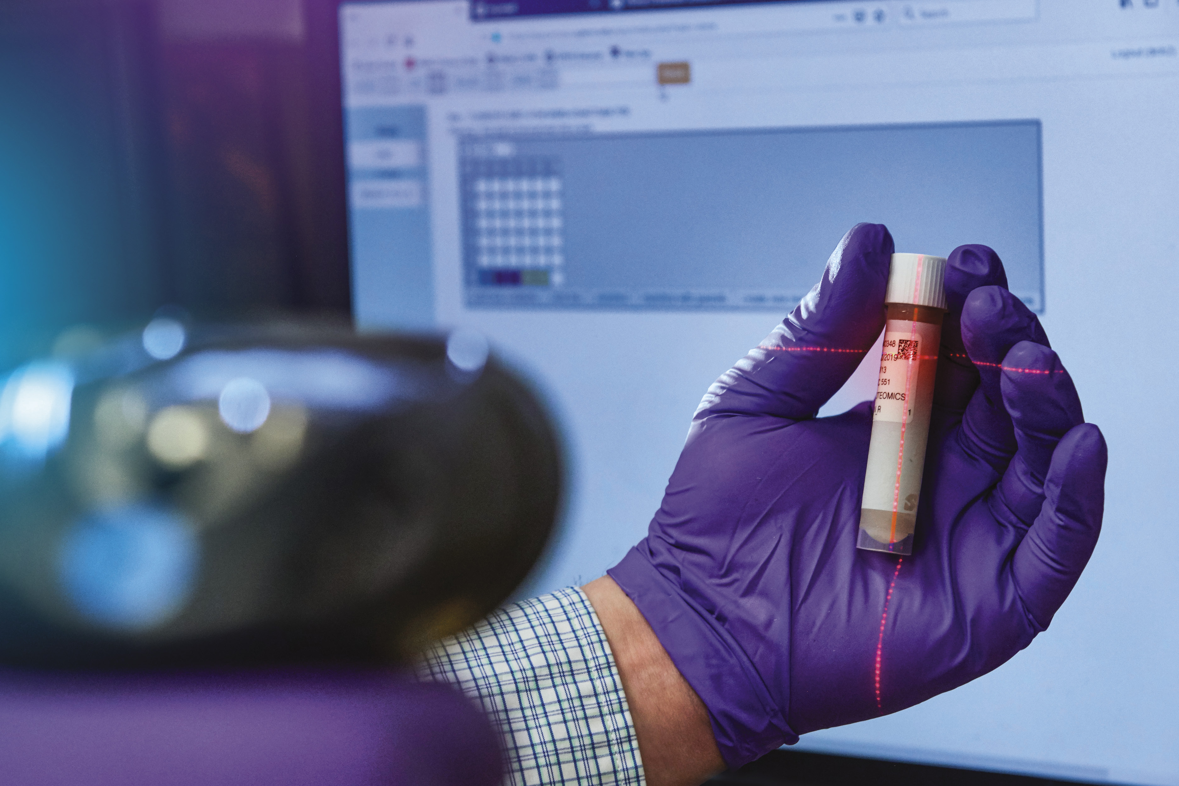 scanning a kidney research vial