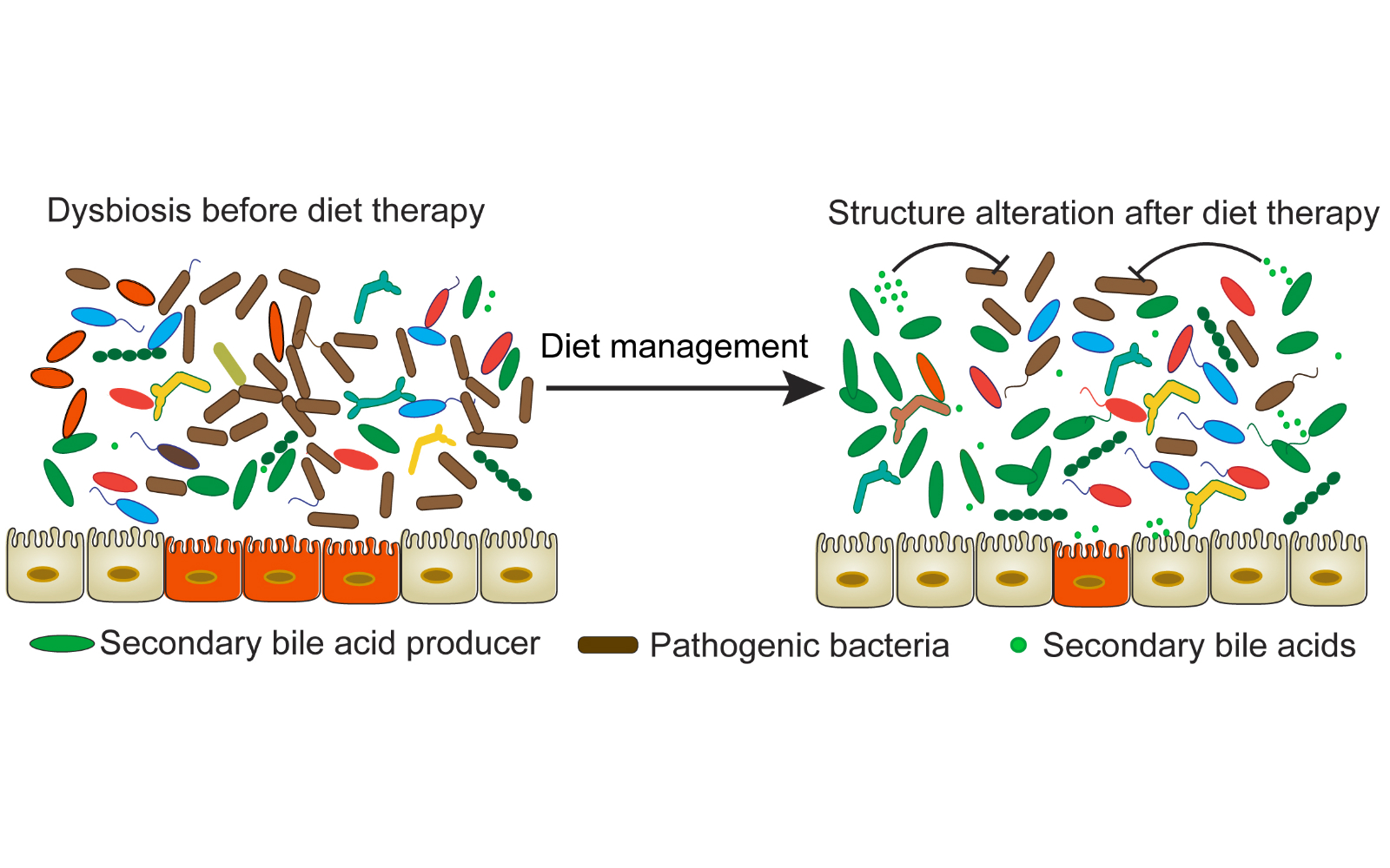 scientific diagram shows transition of the microbiome with diet. dysbiosis before diet therapy is transformed by diet management with a structure alteration after diet therapy. After image shows more secondary bile acid producers, fewer pathogenic bacteria, and more secondary bile acids