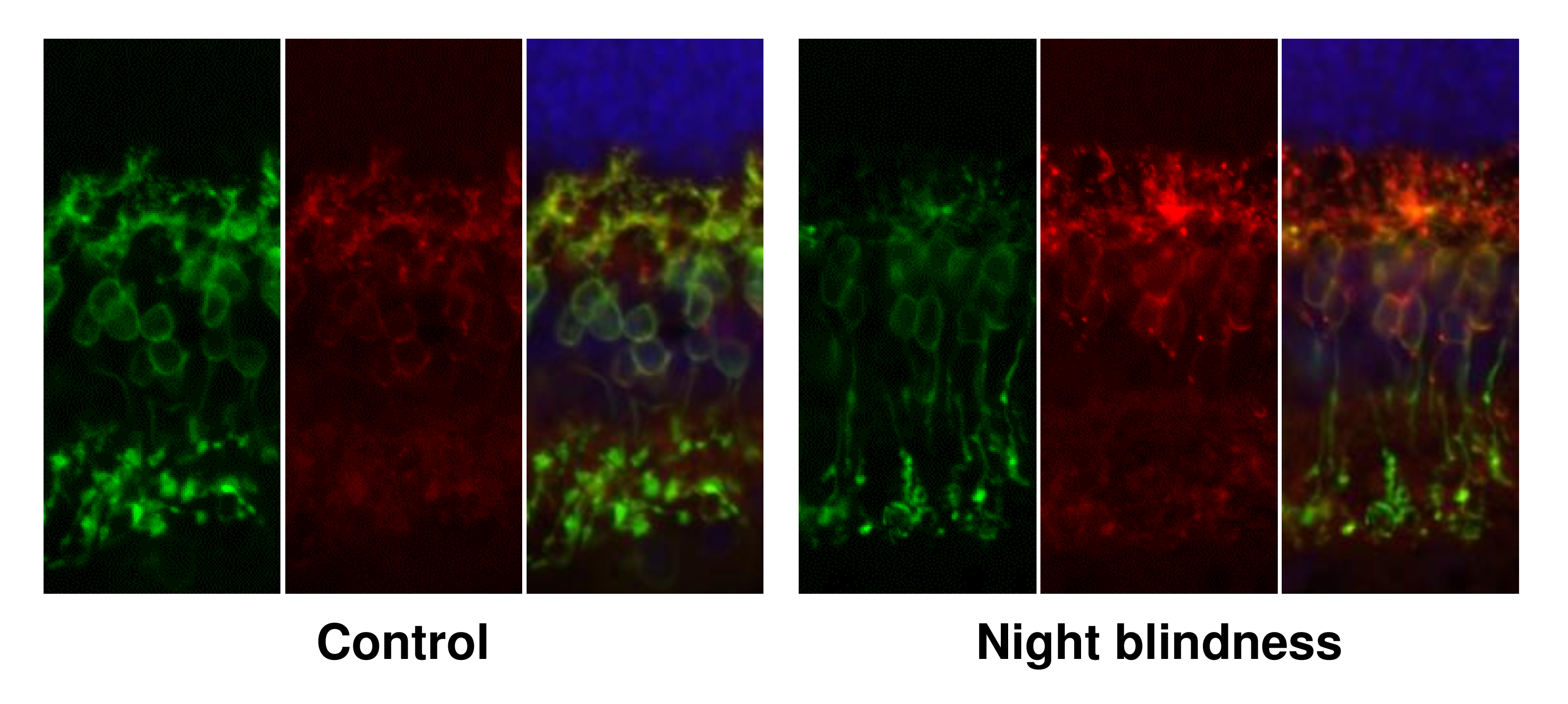 Six panels, three labeled "control" and three labeled "nightblindness" show fluorescent-labeled cells in different colors.