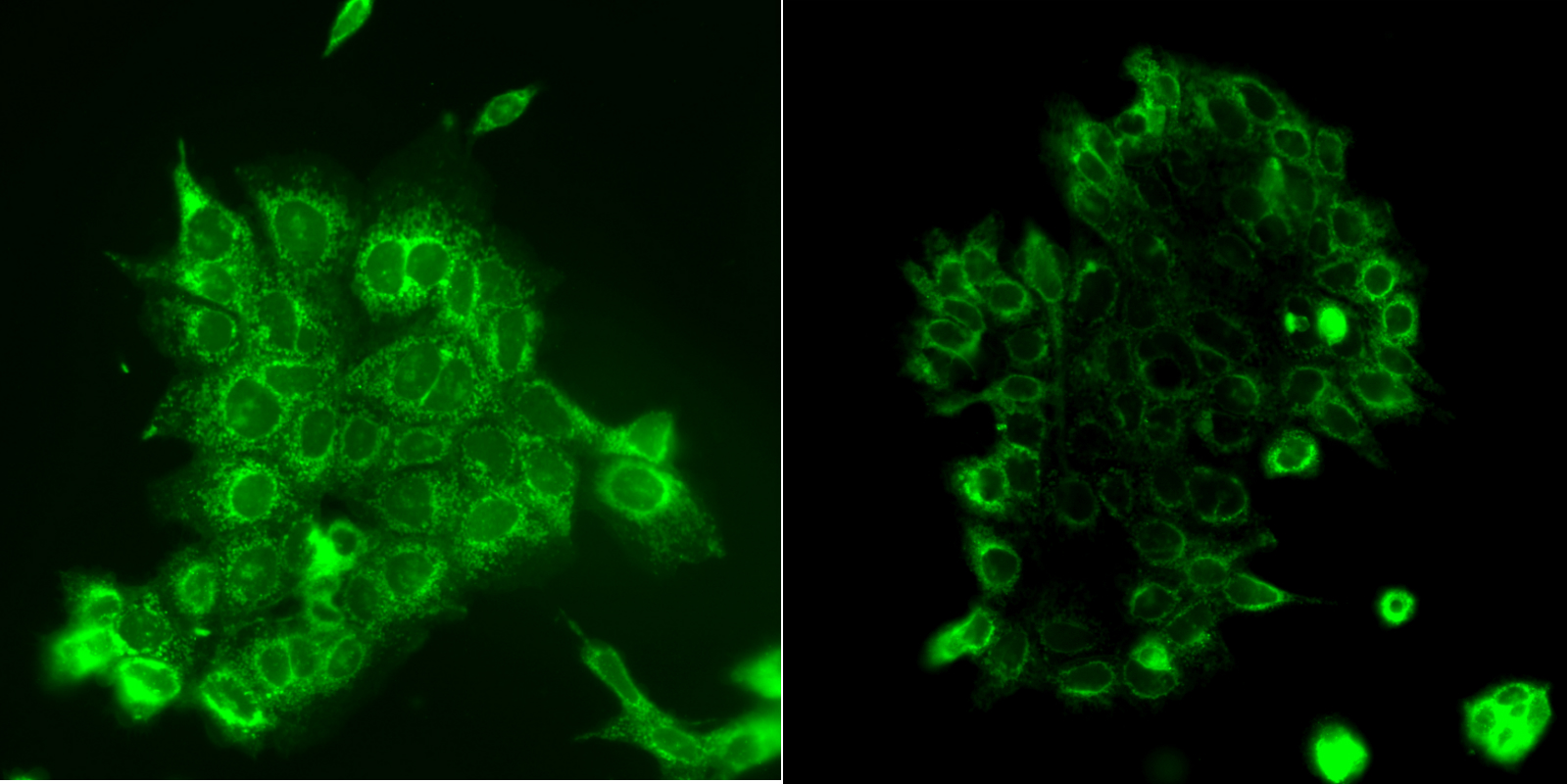 Side-by-side microscope images of mitochondria in mammary gland cells, indicate by fluorescent green. The left panel shows more fluorescence.