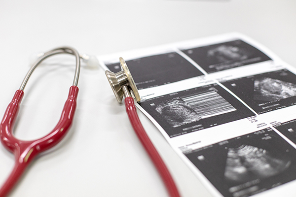 stethoscope on a table beside an ultrasound image