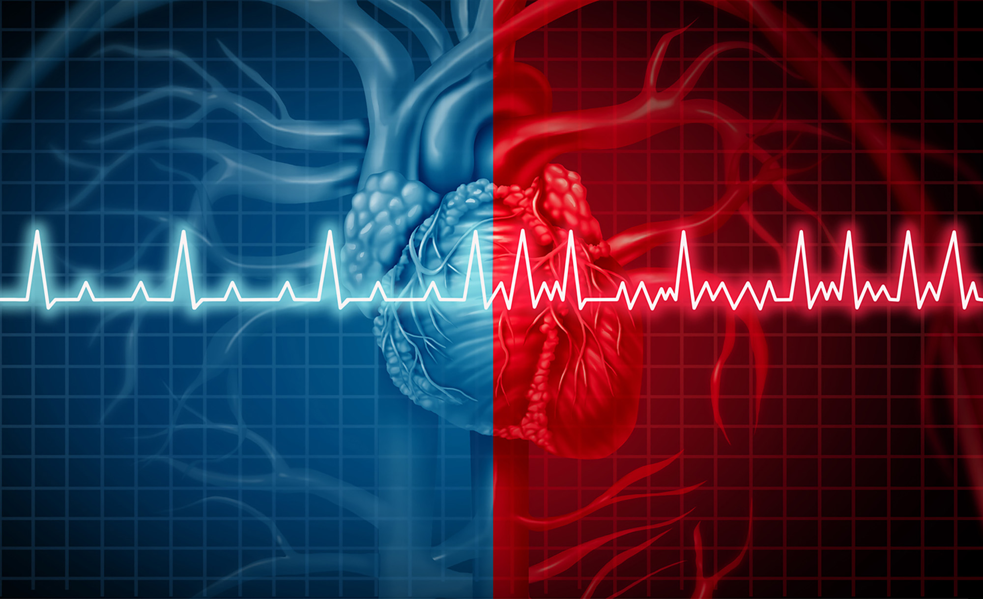 heart overlaid with depiction of irregular heartbeat