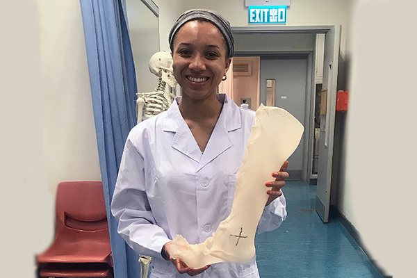 Ruby Washington holds a bioengineered cast in the shape of a human leg.