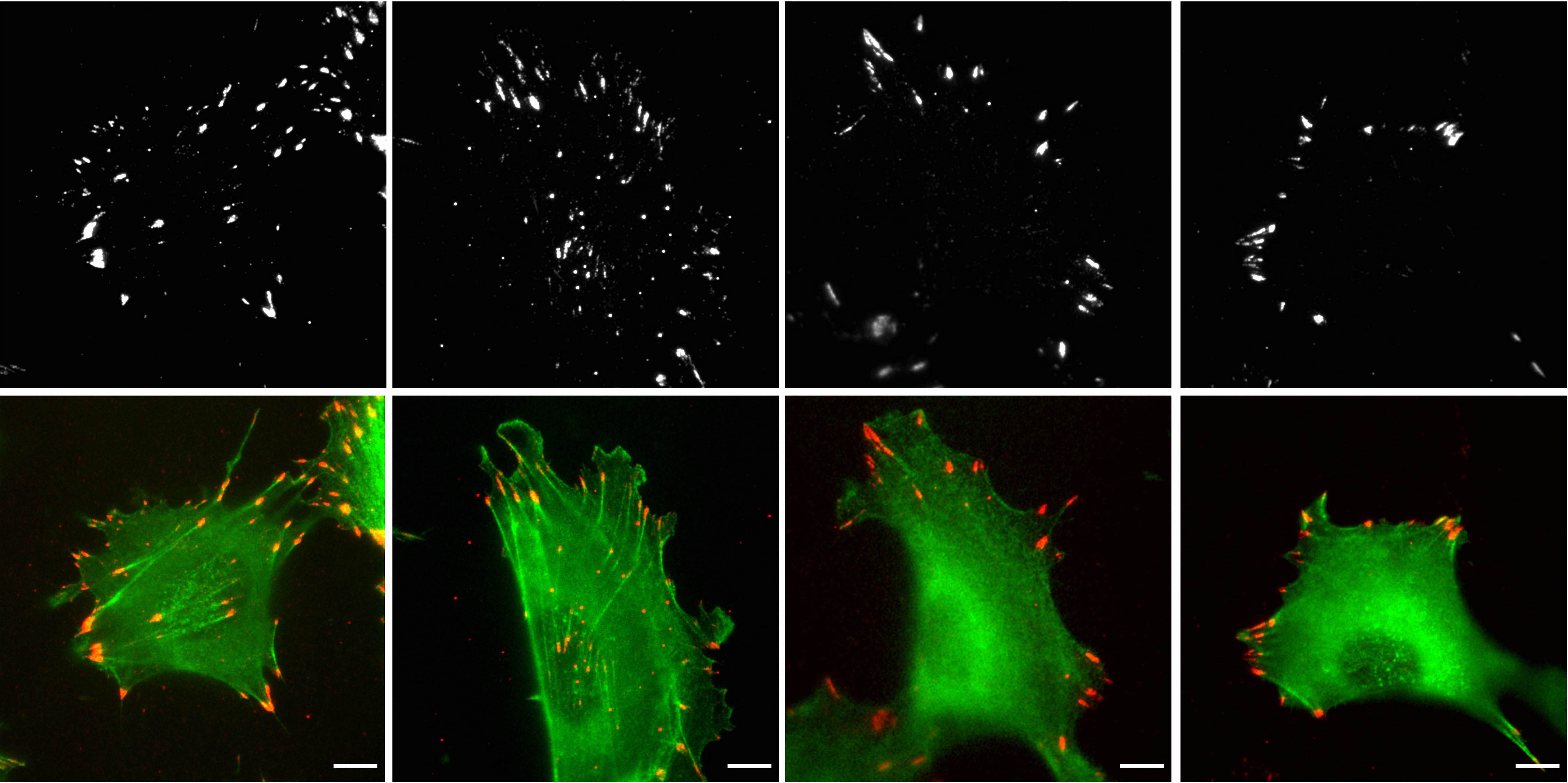 six panels showing cells in green with protein involved in cell movement labeled in red