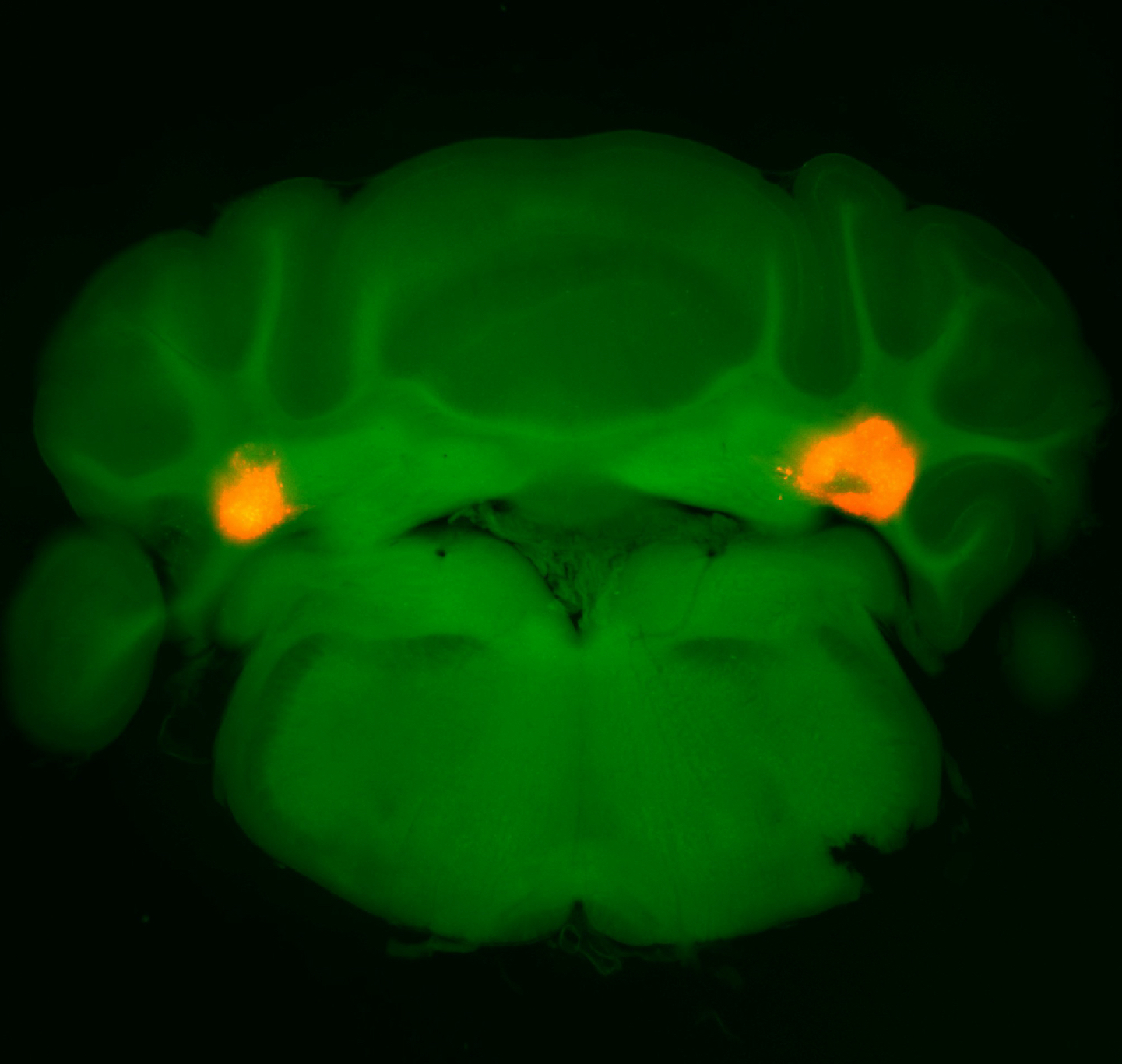 Image of brain cross section in fluorescent green with orange spots on either side