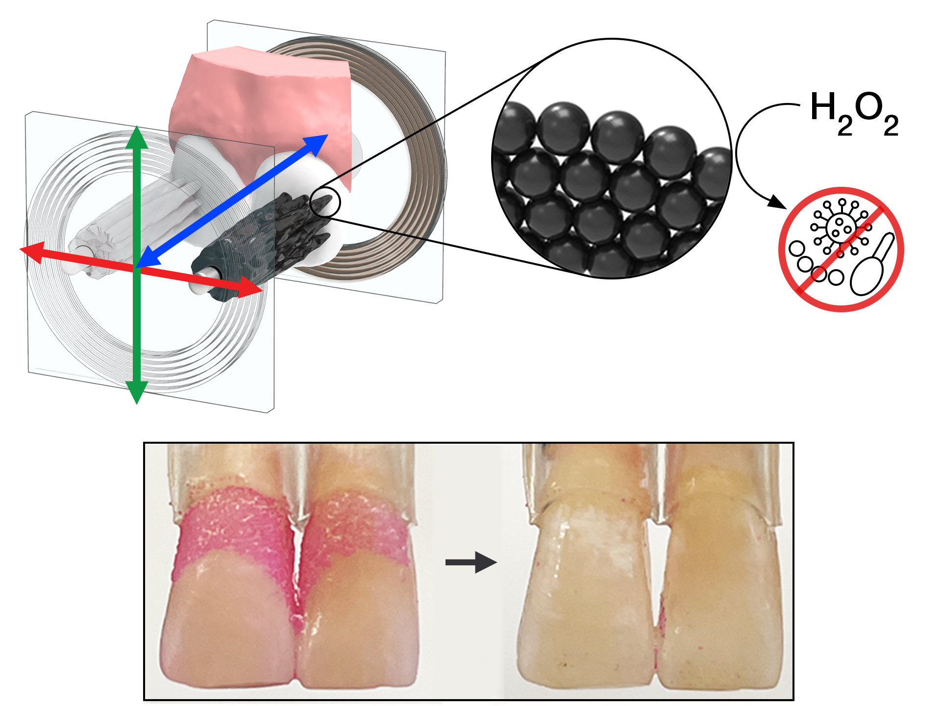 Graphic shows how nanoparticle-based microrobots can remove dental plaque from teeth with their motion and the activity of hydrogen peroxide (H2O2) to kill microbes