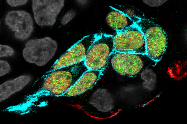 microscopic image with blue, red, and green fluorescent labeling indicates cells that are developing to resemble germ cells
