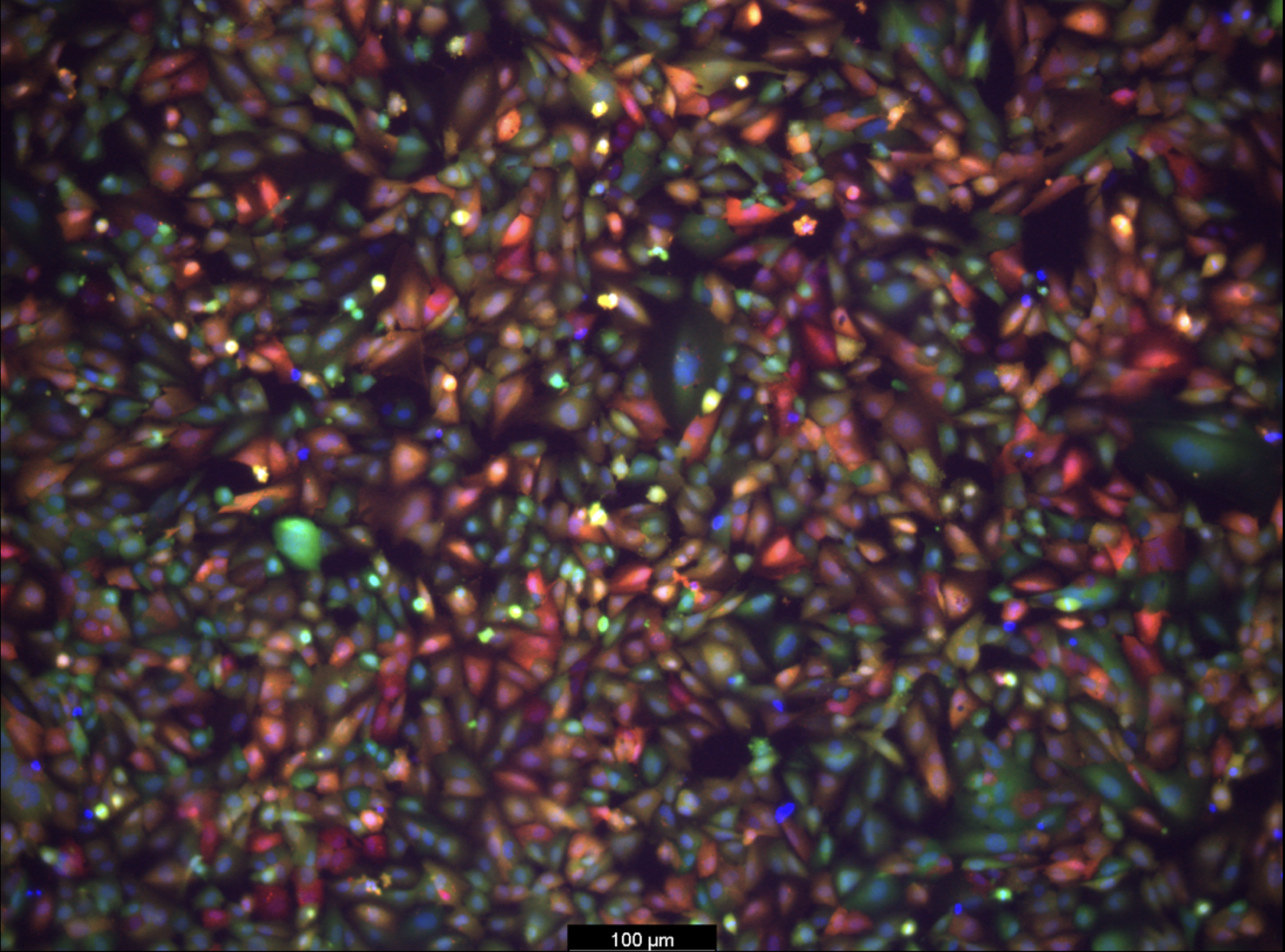 Fluorescence microscopy image showing LNPs delivering mCherry mRNA to brain endothelial cells.