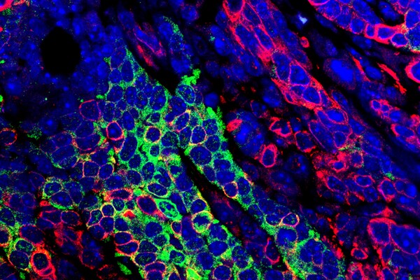 Fluorescent microscopic image shows mammary gland cells