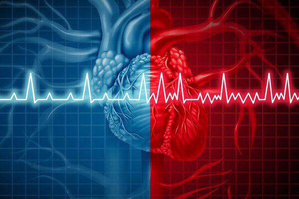 heart overlaid with depiction of irregular heartbeat