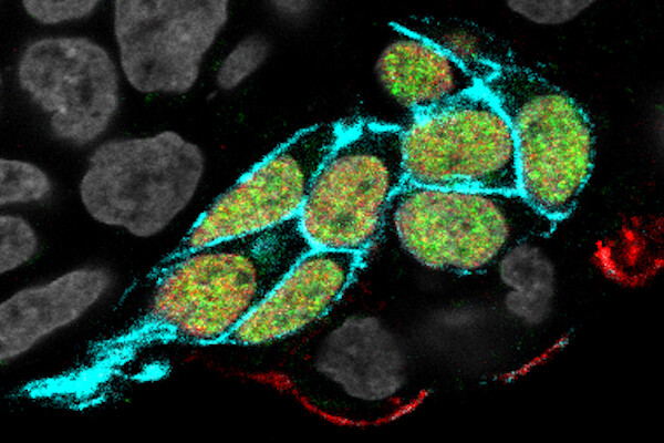 microscopic image with blue, red, and green fluorescent labeling indicates cells that are developing to resemble germ cells