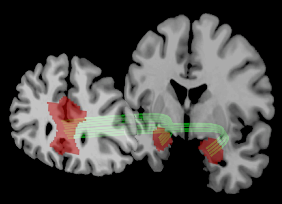 A new study from Penn researchers Joseph Kable and Caryn Lerman linked the amygdala and the prefrontal cortex to risk tolerance.