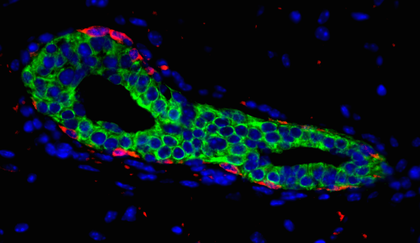 Chakrabarti.mammary gland.2018