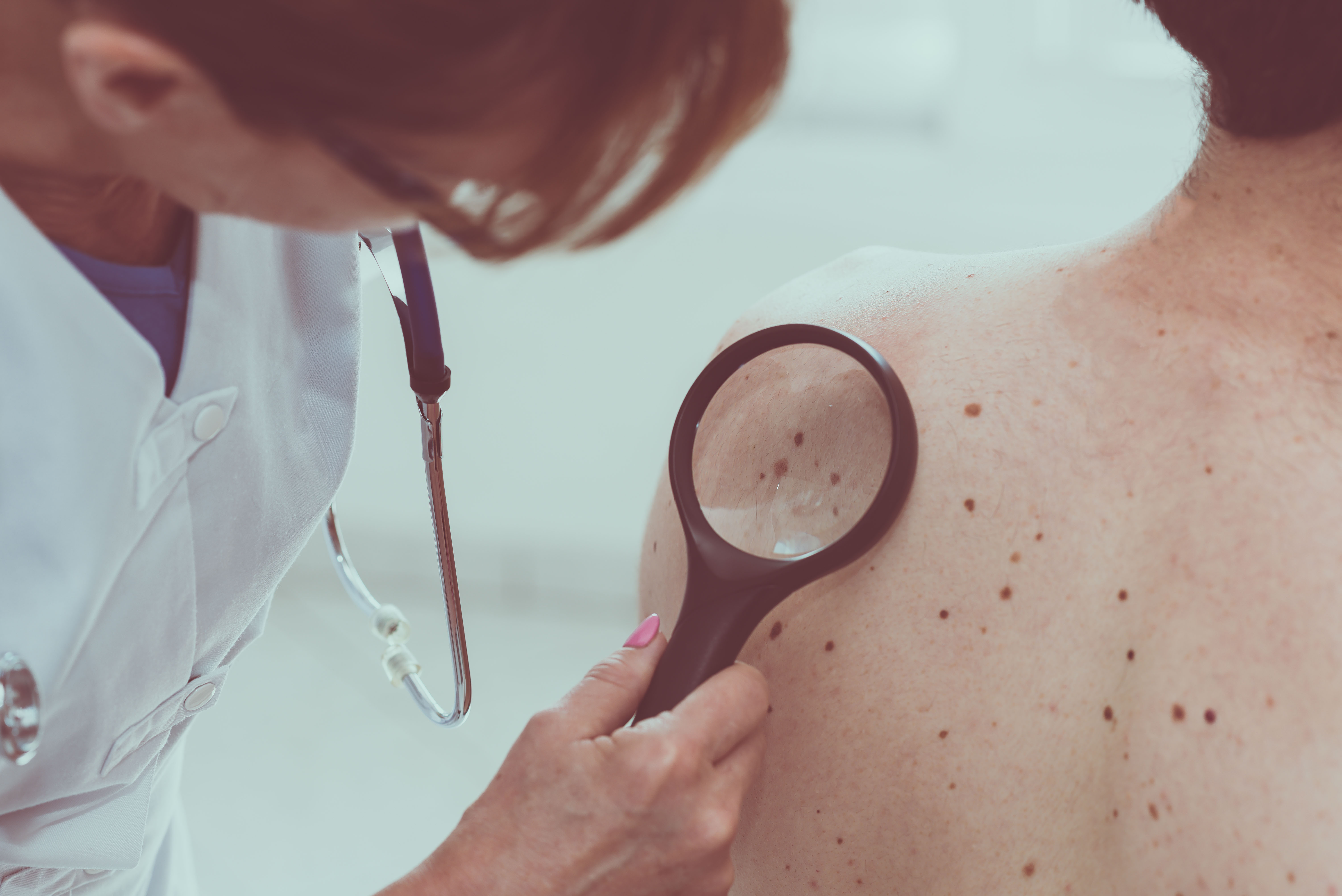 Dermatologists offer tips on how to prevent and detect skin cancer | Penn  Today