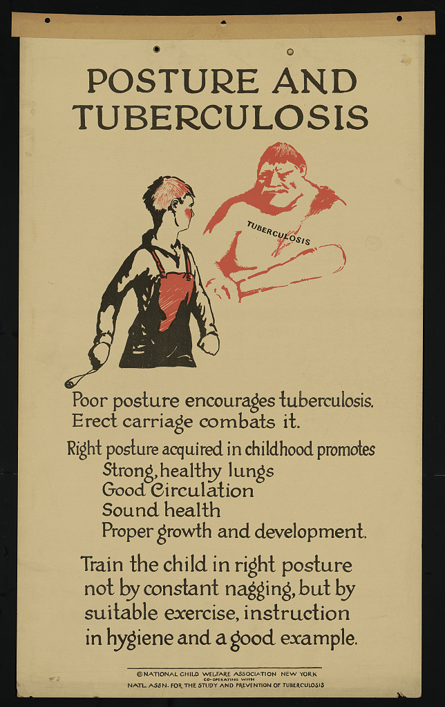 Linker.posture and TB