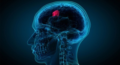 brain_tumor