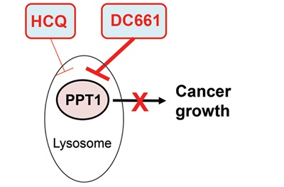technical rendering of an oval representing cancer growth
