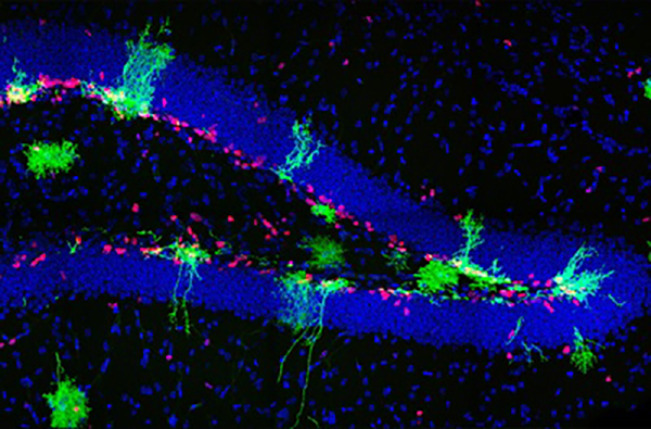 Neurons in the dentate gyrus of the hippocampus