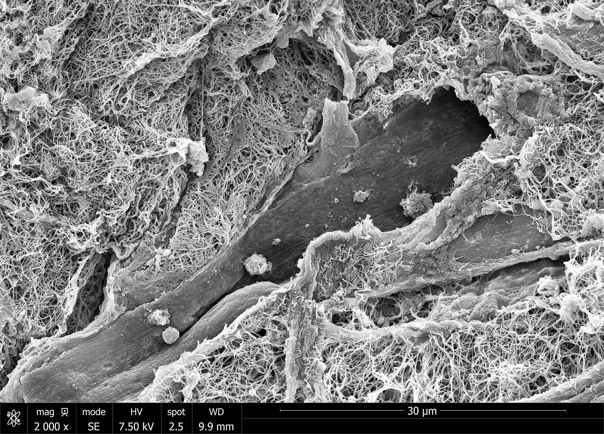 Microscopy photo of blood vessel crimping