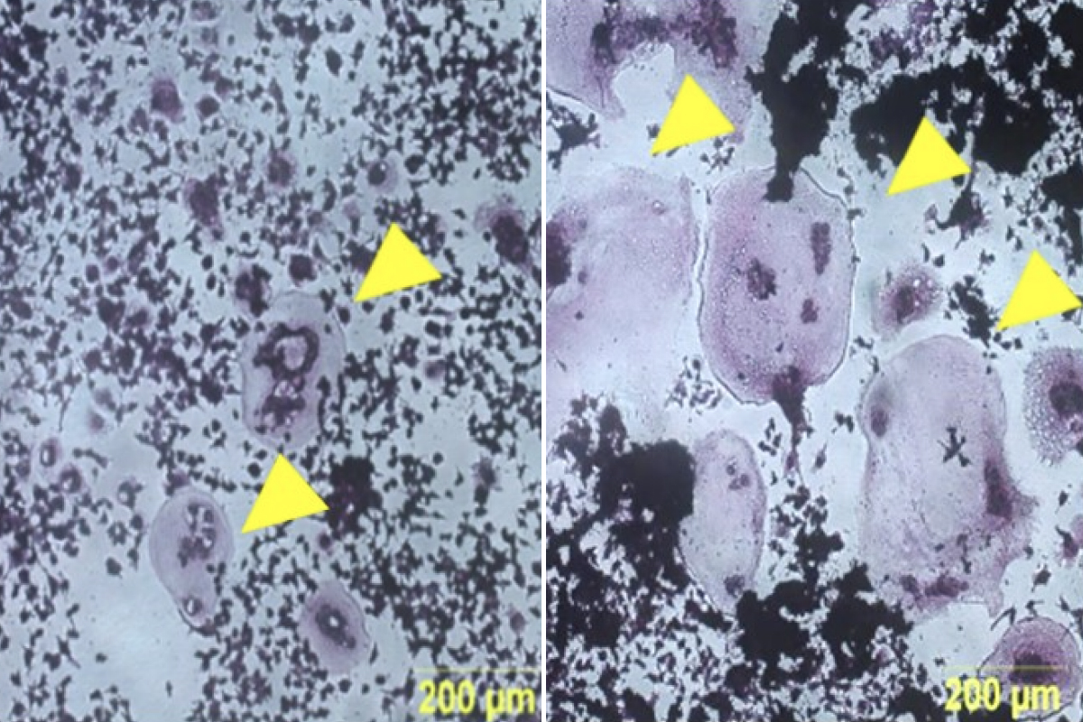 Yellow pointers indicate large cells against a background of other microscopic material. Left panel has two smaller cells indicated while the right panel has three larger cells indicated.