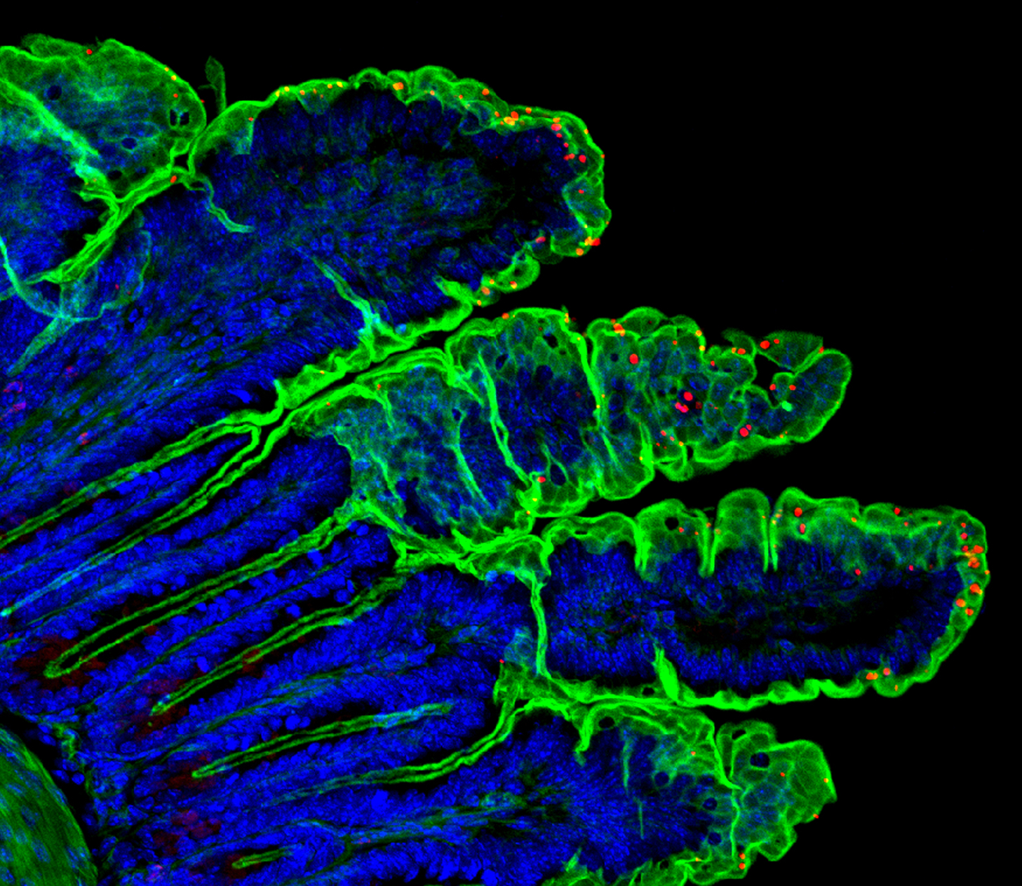 Fluorescent microscopic images shows a section of intestine with blue, green, and red labels.