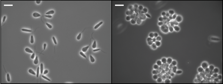 Microscopic images of two types of Crithidia parasite, swimming versions with tails on the left and rosette bundles on the right