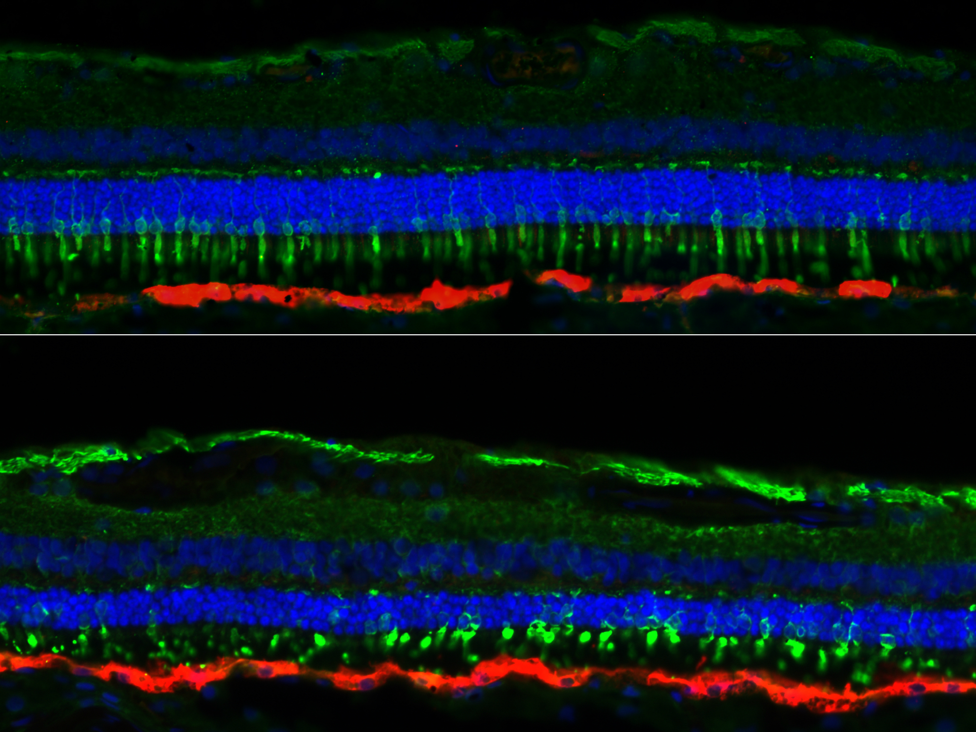 Top-and-bottom show fluorescent, microscopic images of layers of the eye's retina in blue, green, and red.