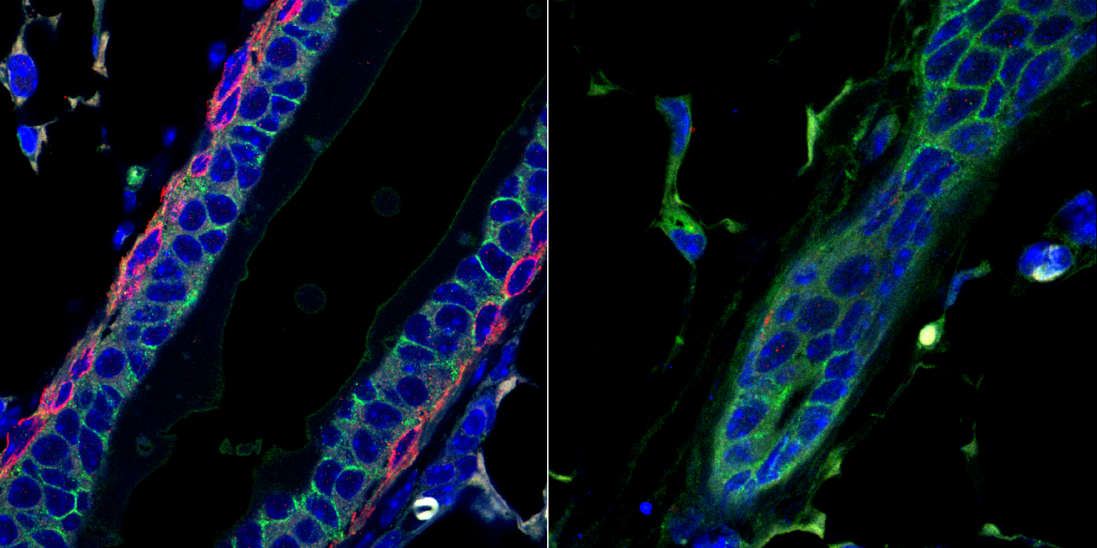 Side-by-side microscope images of a mammary gland duct. Right panel shows it is less well formed.