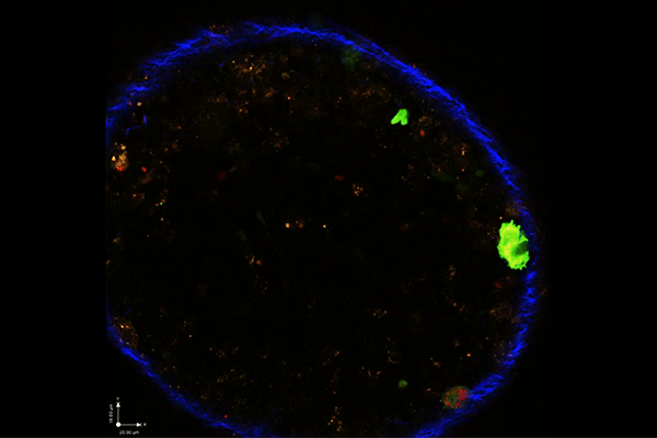 Fluorescent microscopic image shows Toxoplasma parasite infecting immune cells