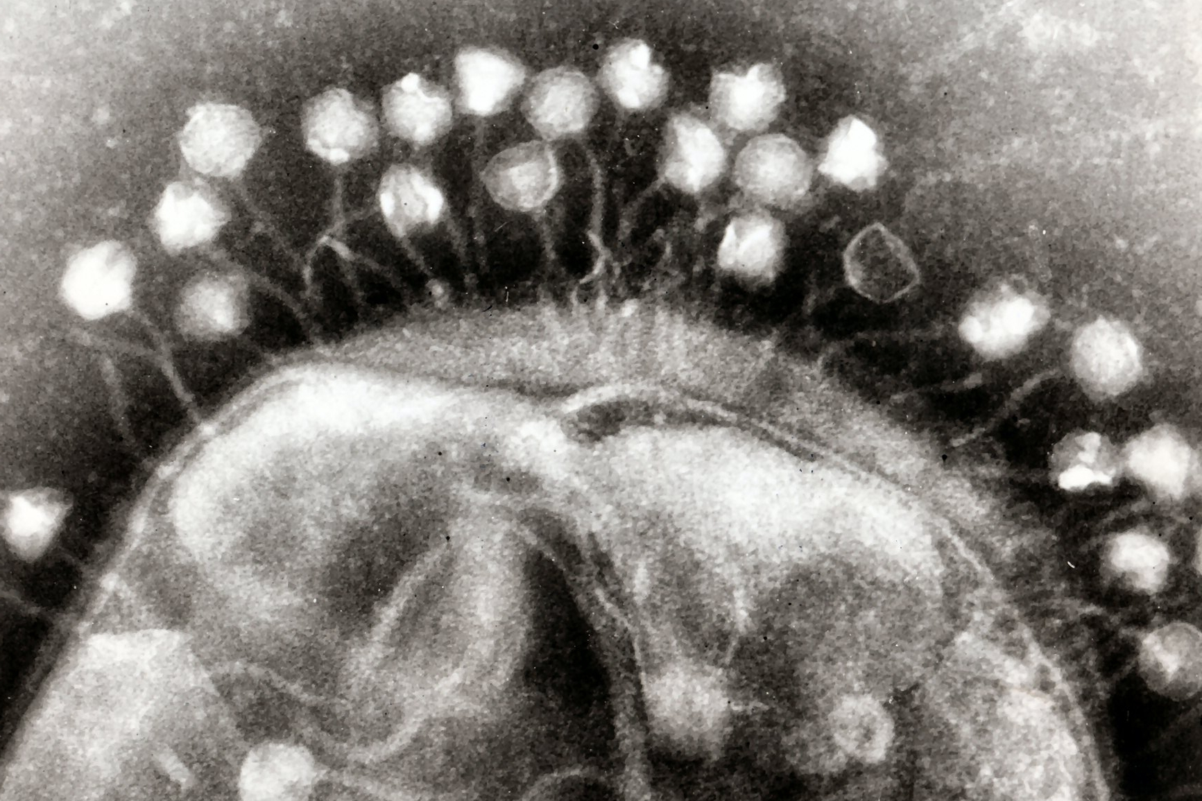 electron micrograph of bacteriophages attached to a bacterial cell