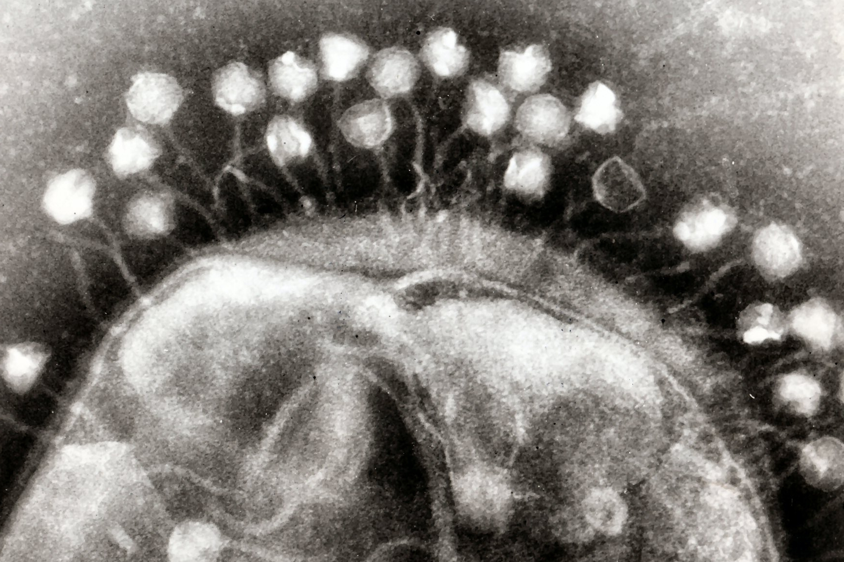 bacteriophage virus electron microscope