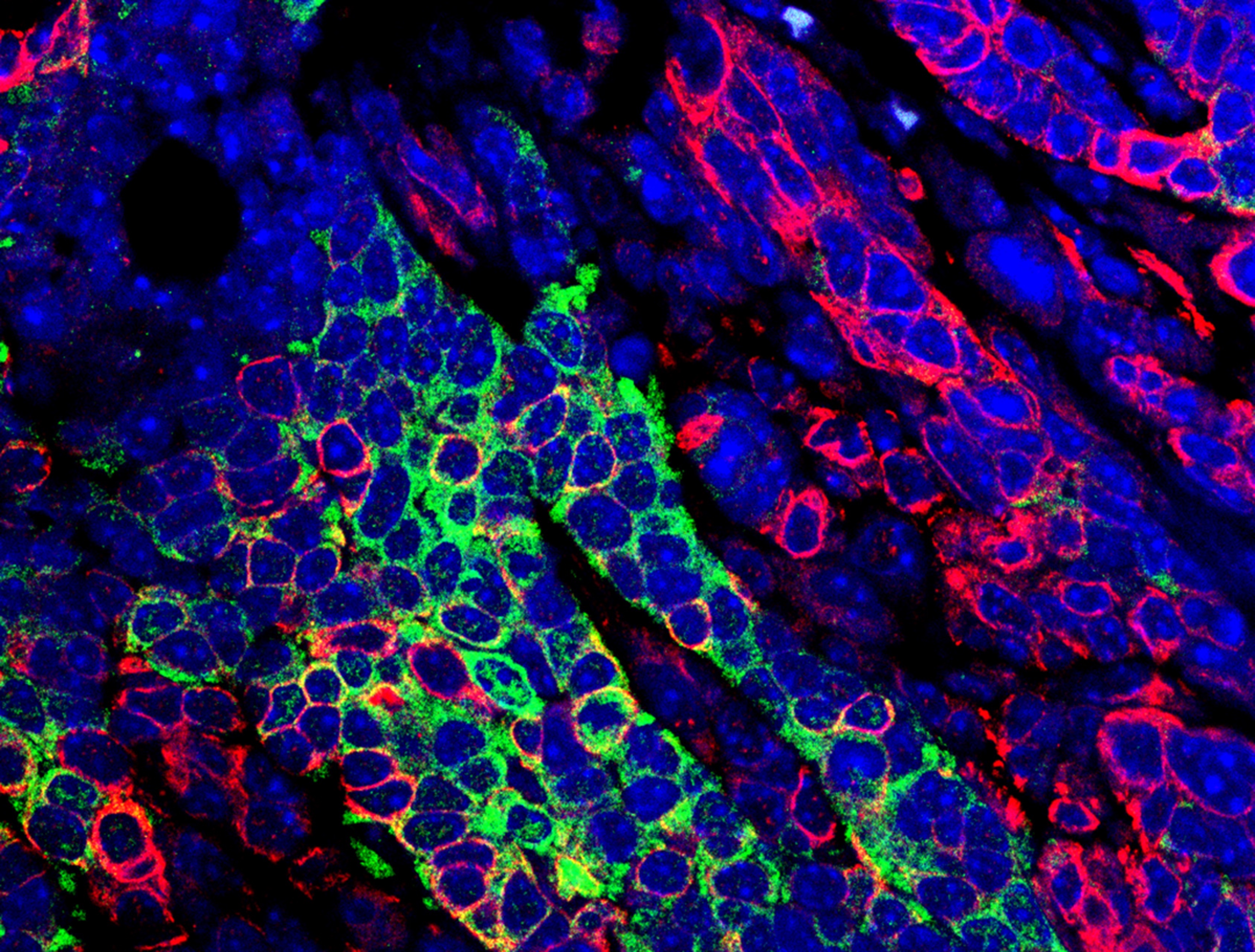 Fluorescent microscopic image shows mammary gland cells