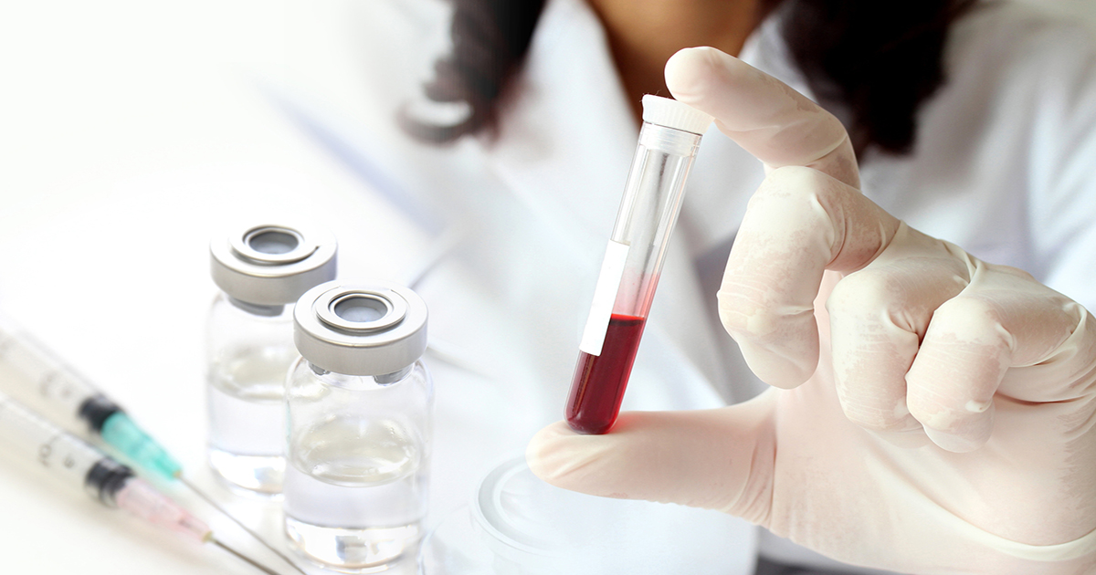 Blood test may help doctors catch pancreatic cancer early