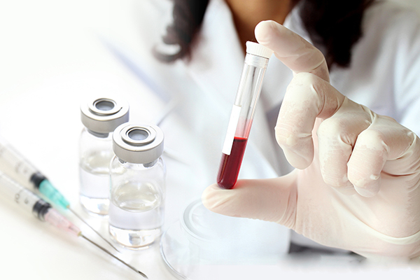 Gloved hand holds a vial of blood for a blood test