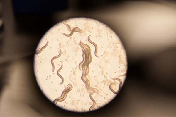 Microscopic image of C. elegans.