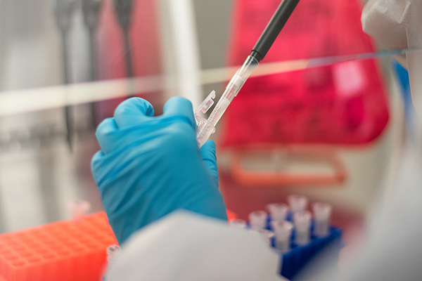 closeup view of gloved hand holding a vial and pipette in a medical lab.
