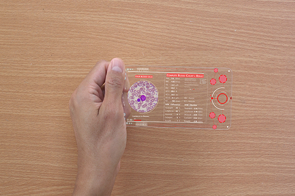 Hand holding clear plastic plate displaying blood sugar data.