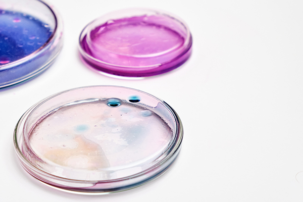 Three petri dishes with different colored substances for microscopic views of bacteria.
