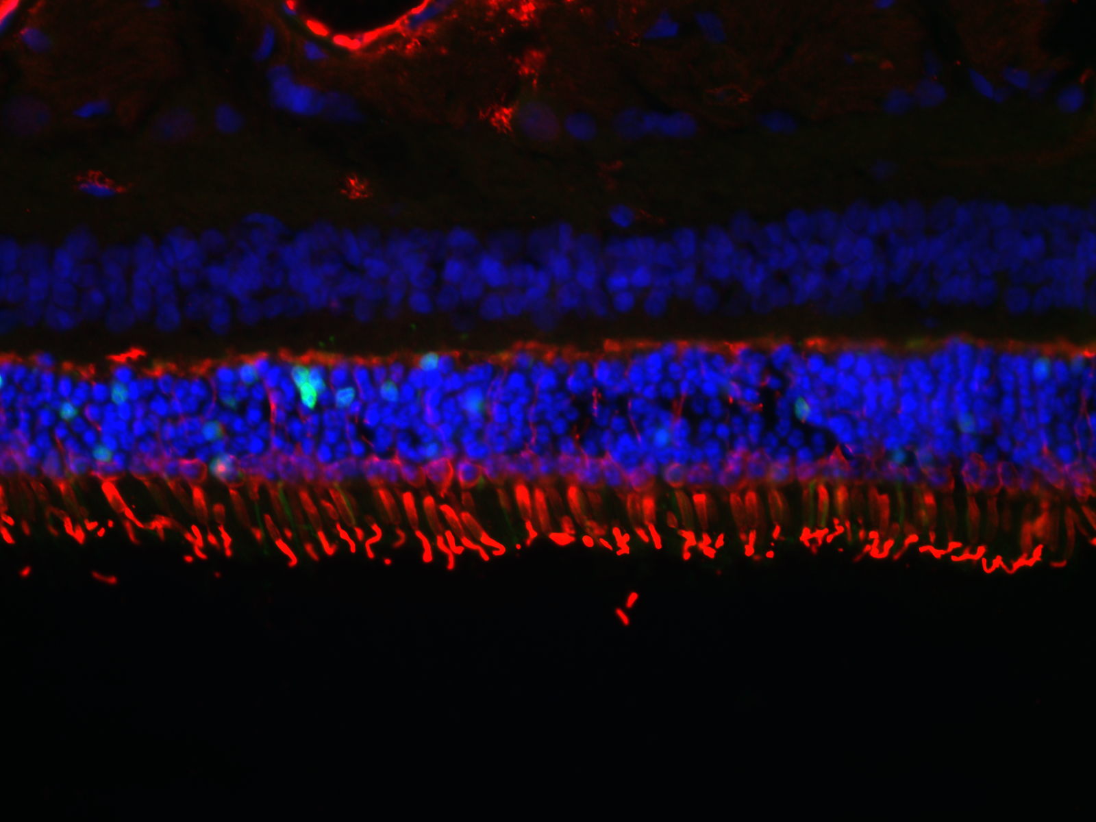 microscopic image of retinal tissue layers labeled in red and blue