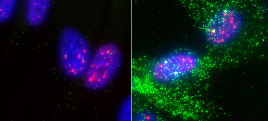 Left image: microscopic nucleus of a cell. Right image: Illuminated nuclear speckles surrounding the nucleus of a cell.