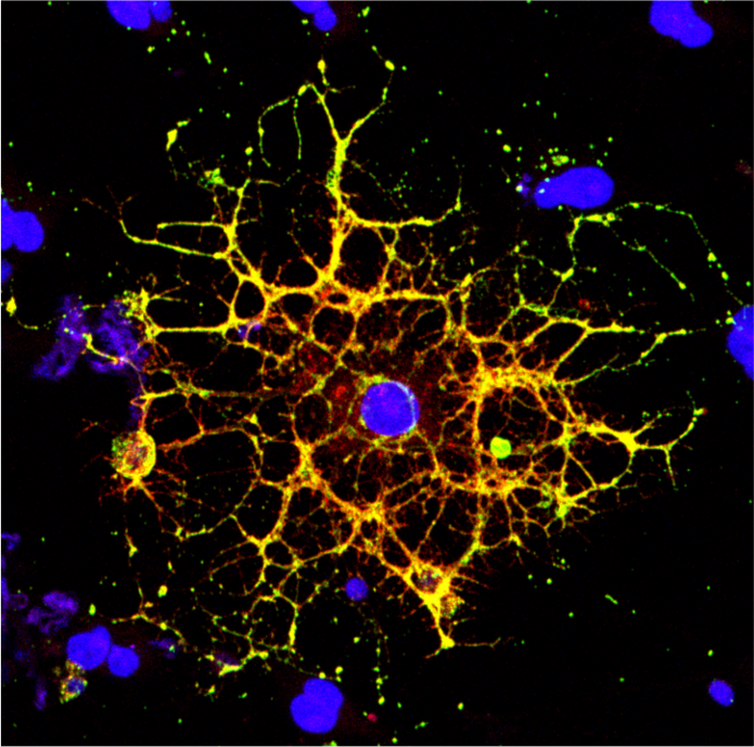 Fluorescent microscopic image of a brain cell stained in blue and yellow