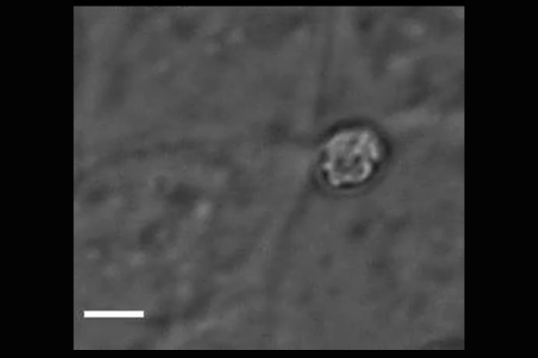 short video of a parasite invading a cell
