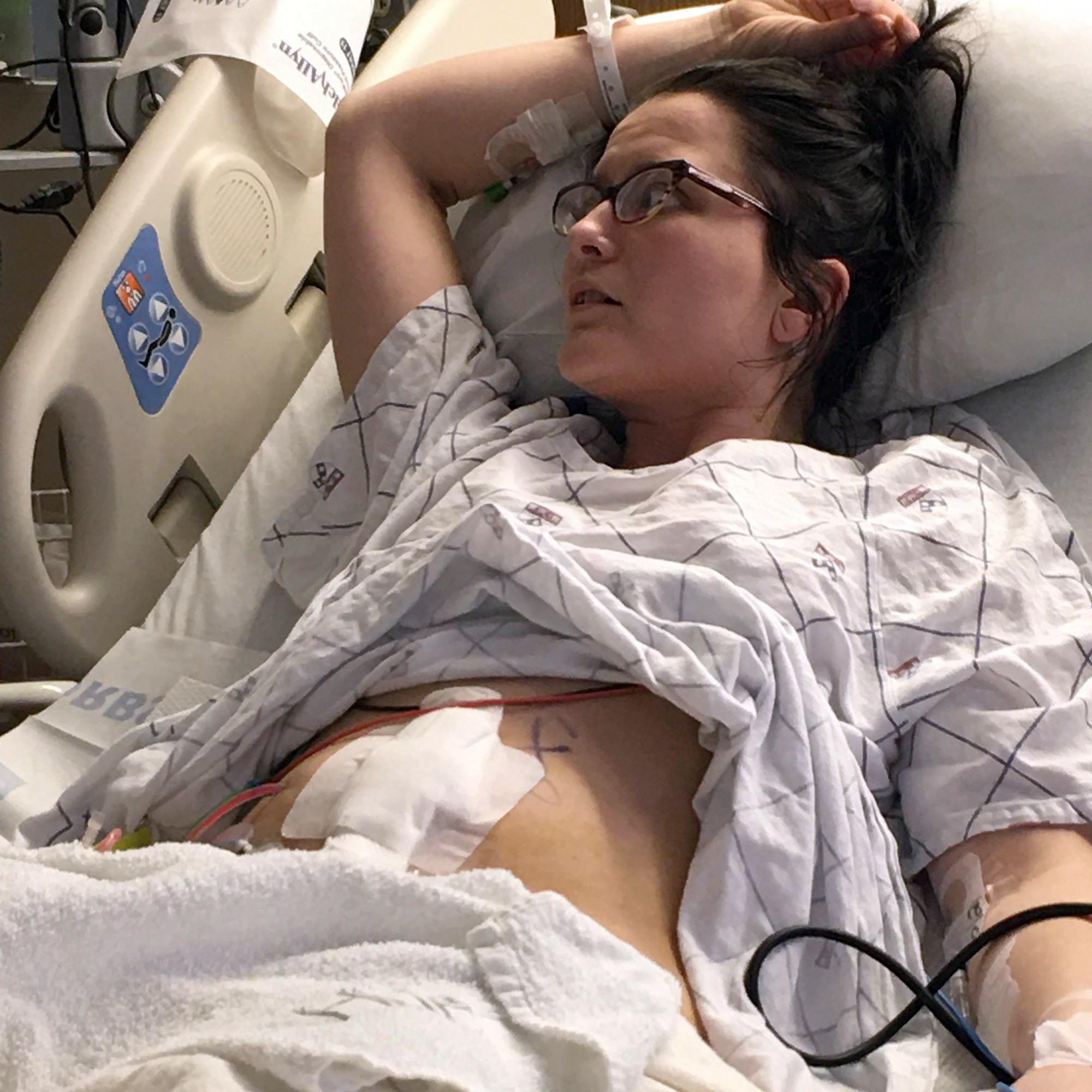 Chelsea Jovanovich at uterine transplant surgery