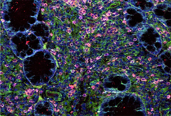 Microscopic multicolor image of a colon.