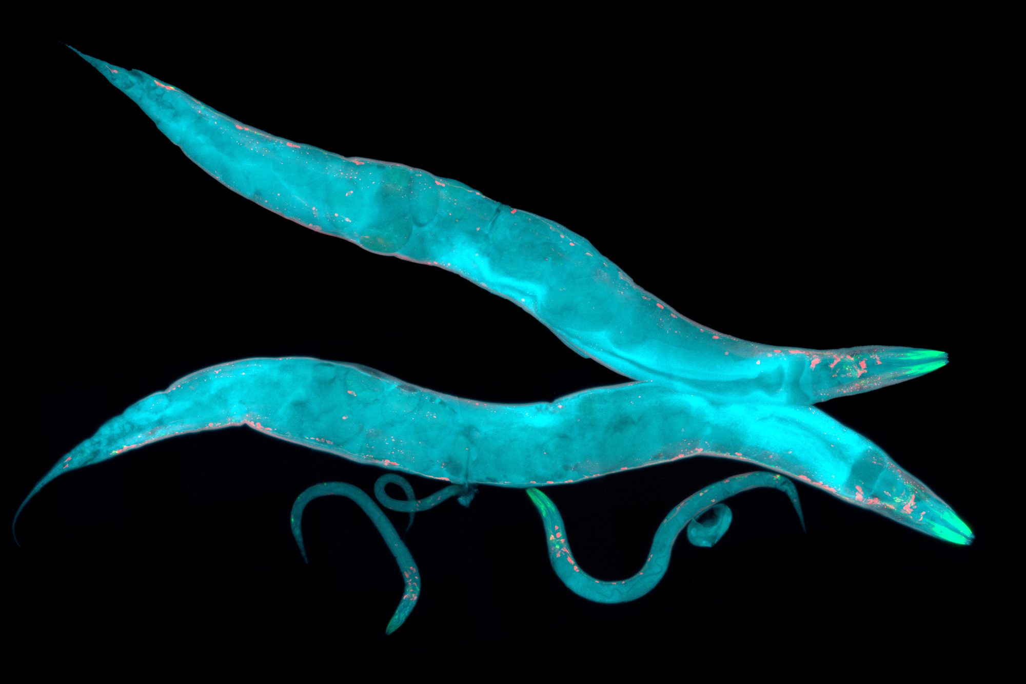 Micrsoscopic view of Caenorhabditis elegans, a free-living transparent nematode, about 1 mm in length