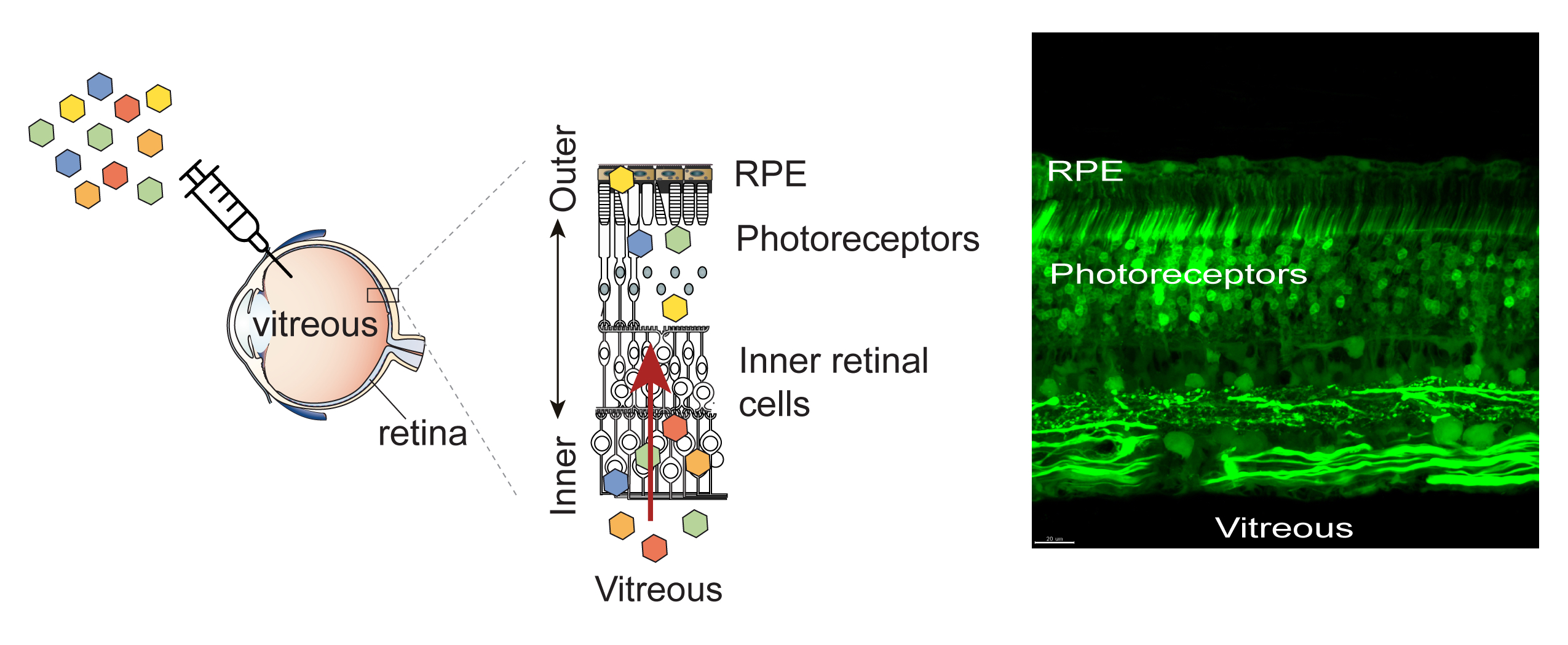 Retina - Gene Vision