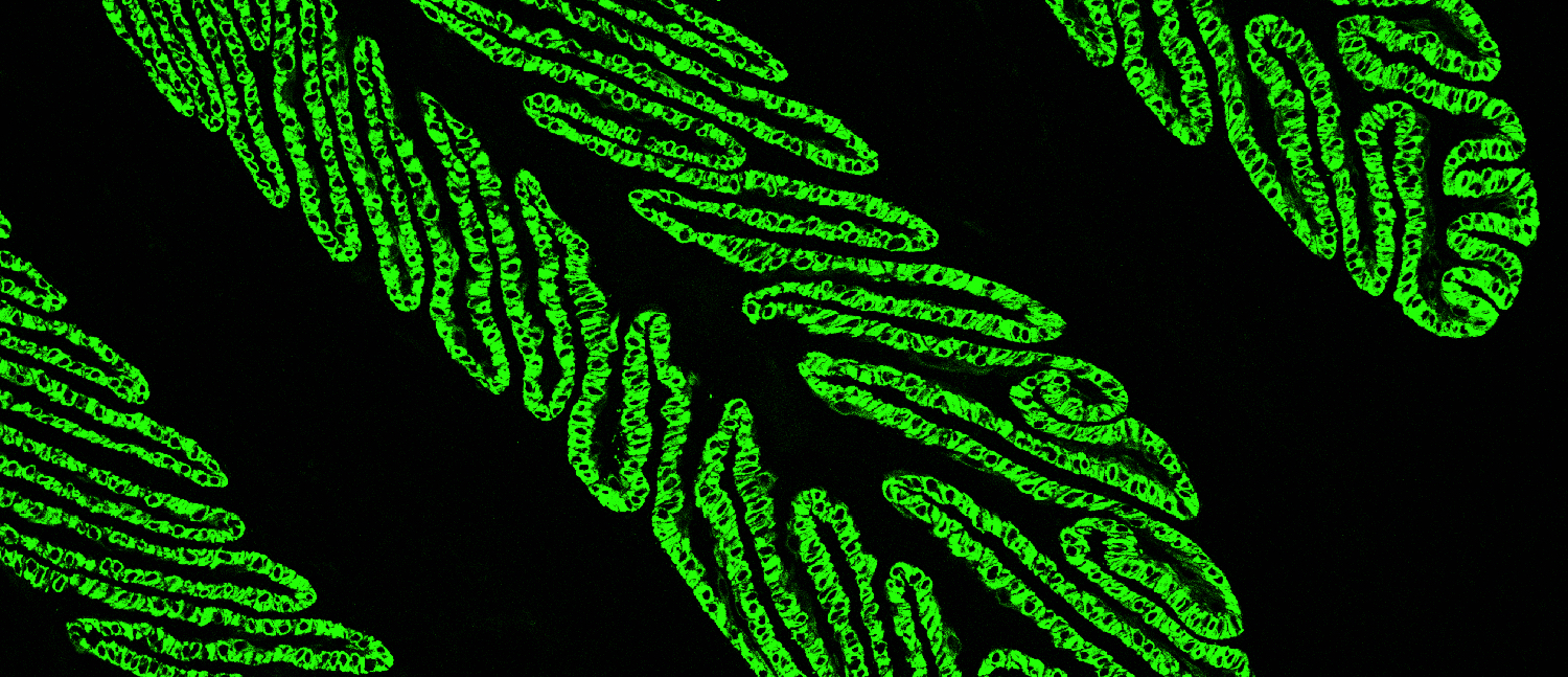 Microscopic image of fluorescently labeled lamellae in a horse hoof