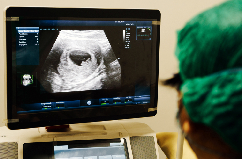 An ultrasound technician looks at an ultrasound on a screen in a hospital.